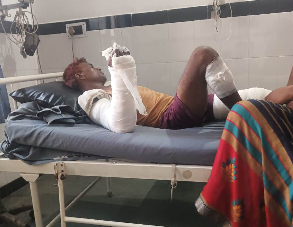 Bareilly News : घर से काम को निकले मजदूर को रास्ते में दबंगों ने पीटकर किया गंभीर घायल, रिर्पोट दर्ज 