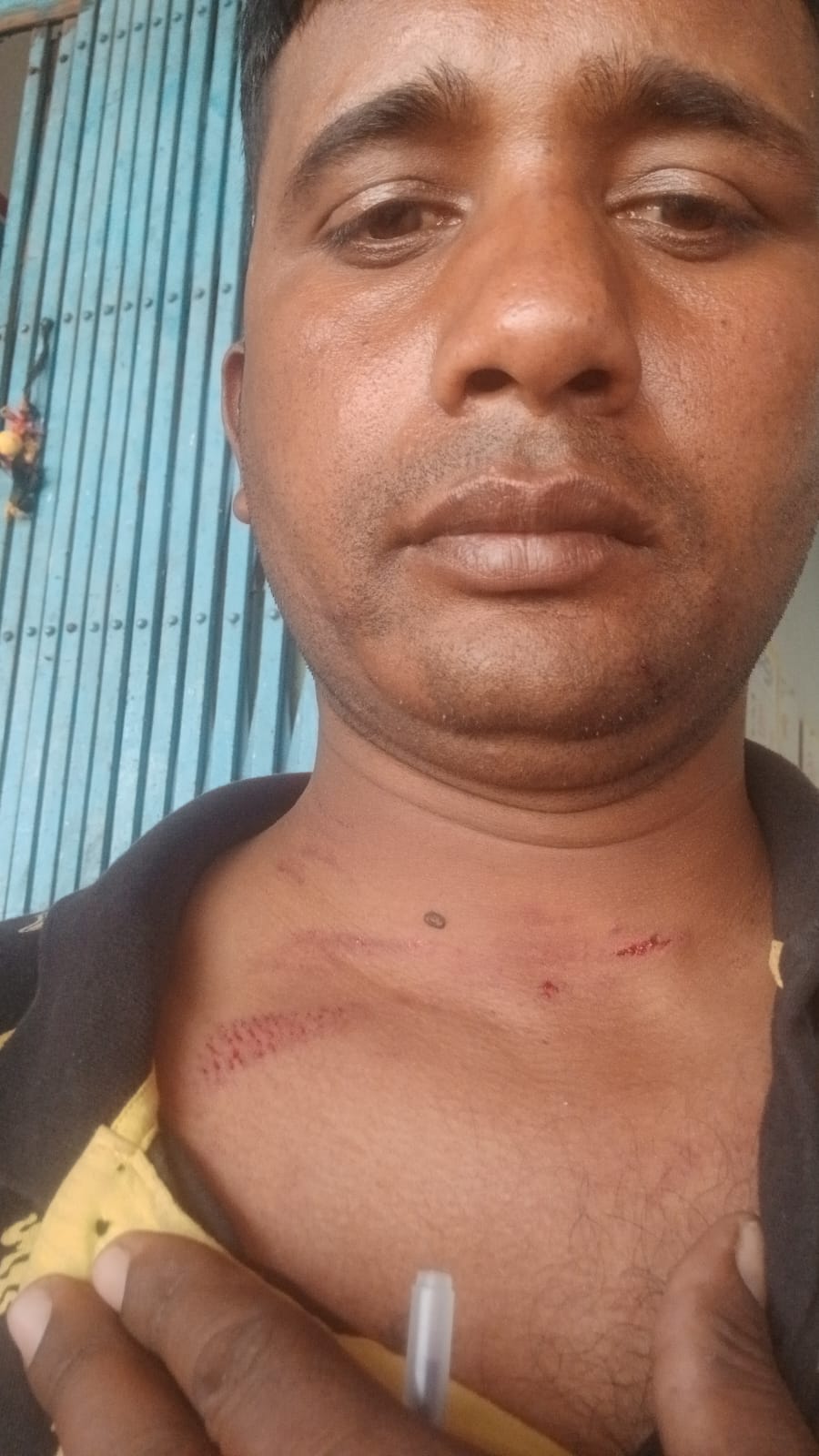 Badaun News : मंदिर में प्रवेश से रोका, दलित युवक से मारपीट