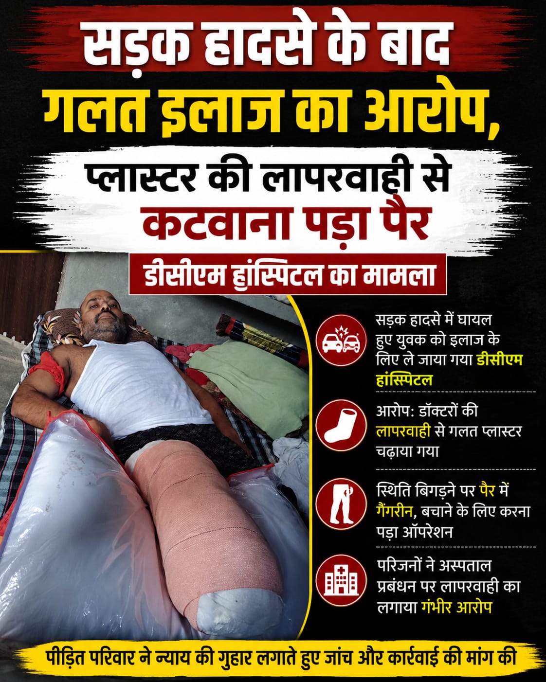 KASGANJ NEWS सड़क हादसे के बाद गलत इलाज का आरोप, प्लास्टर की लापरवाही से कटवाना पड़ा पैर, डीसीएम हांस्पिटल का मामला
